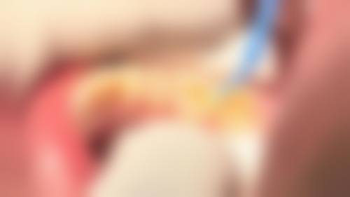 河南新乡立德口腔门诊真实实例