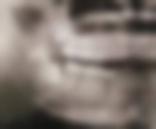 重庆合川区玲琍口腔真实实例：见证治疗成效