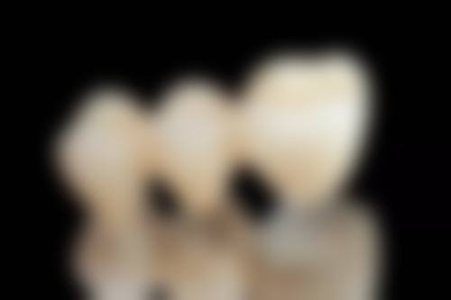 申珊珊医生真实实例:见证神奇的口腔改变