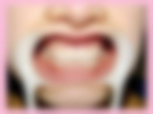 济宁遇见牙博仕口腔门诊部口碑怎么样