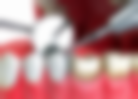 广东肇庆怀集口腔医院真实实例