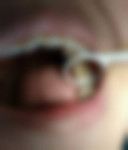 杭州口腔医院临安医院价格表