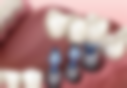 宁夏博诺德口腔门诊部擅长项目：满足多样口腔需求