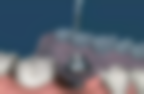 江苏苏州常熟雅康口腔门诊真实实例