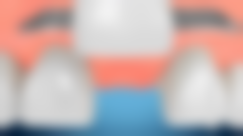 早上拔牙前没吃早餐会怎么样