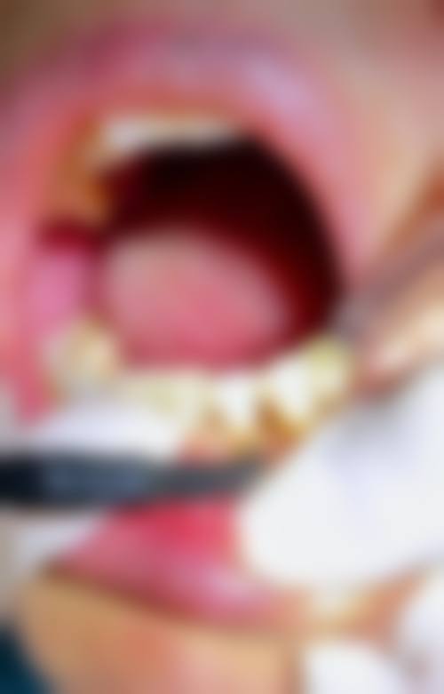 新疆喀什市牙博仕口腔口碑怎么样