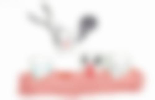 幼儿期地包天矫正后要注意什么