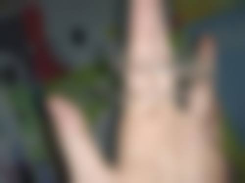 江苏苏州工业园区星雅口腔真实实例