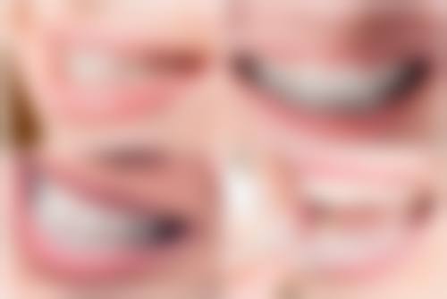 换牙期间矫正地包天靠谱吗