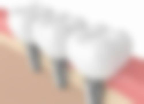 山东德州武城优豪口腔仪器设备：精良科技助力治疗