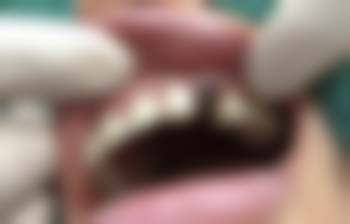 西安雁塔寨西海涛口腔门诊部价格表