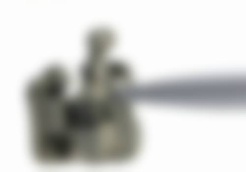 延安海贝壳口腔真实实例：成效看得见