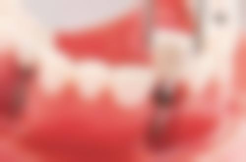 侯马王琳口腔真实实例：见证神奇改变