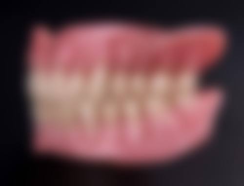 延安海贝壳口腔擅长项目：满足你的多样需求