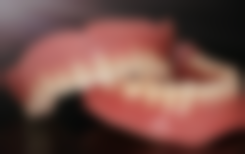 15岁矫正地包天需要多久