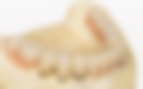 潜江市迪伦口腔擅长项目