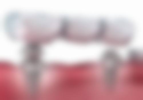 遵义医 科 大学附属口腔医院口腔颌面创伤及正颌外科仪器设备