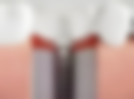 湖南湘潭玉笑口腔口碑怎么样：患者的真实评价