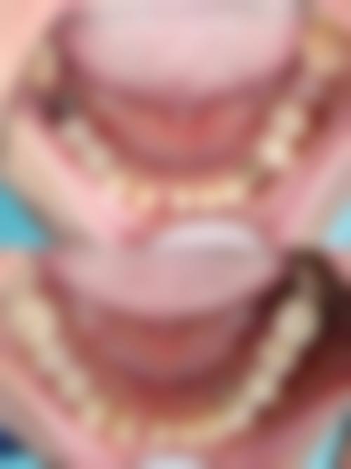 锦江爱牙口腔门诊部擅长项目