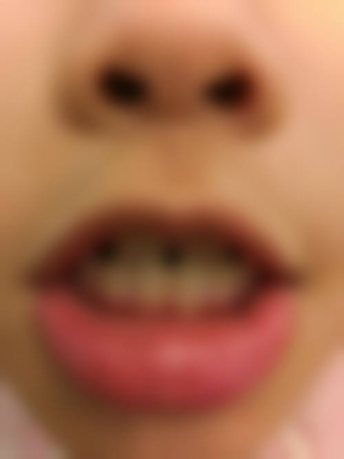 岐山县程玲口腔门诊部擅长项目