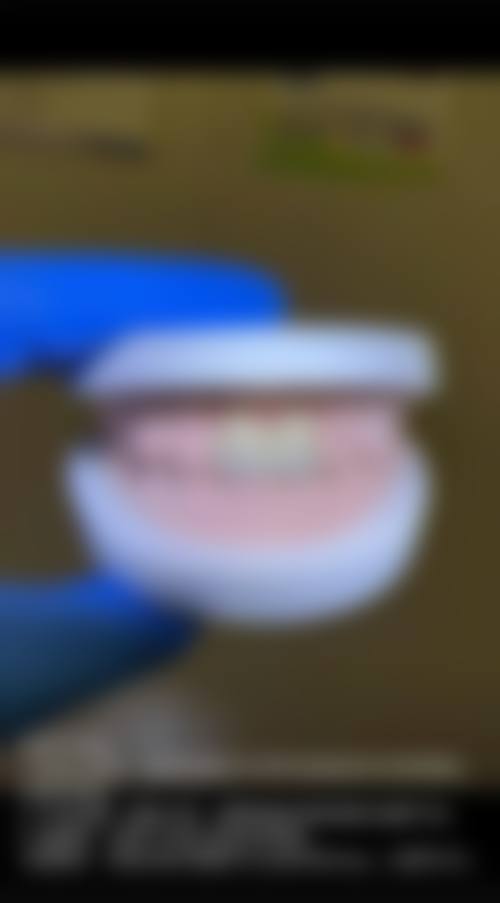 东莞邵淦林口腔诊所真实实例