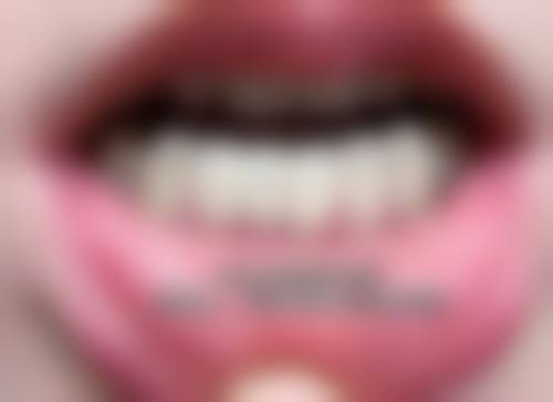 杭州康悦医院口腔科口碑怎么样：患者真实评价见证实力