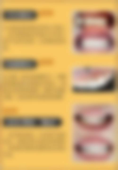 惠州爱雅仕口腔医疗门诊部口碑怎么样