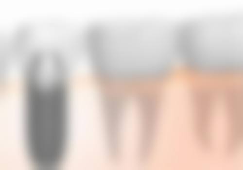 天津和平卓尔口腔诊所擅长项目：全方面满足口腔需求