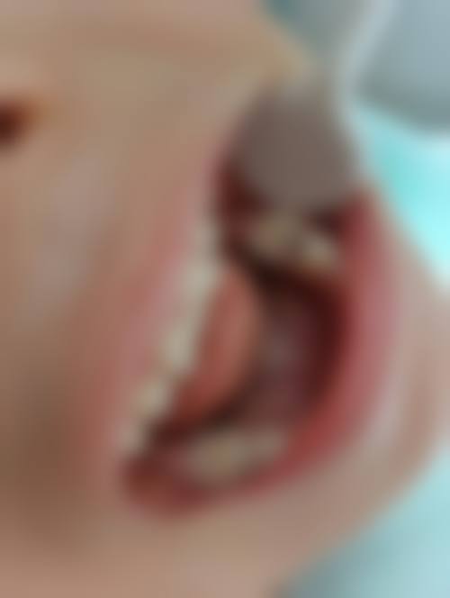 昆明崇臣口腔门诊价格表