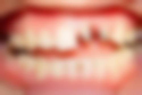 连云港信特口腔价格表