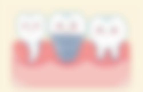 佛山壹加壹口腔（顺德店）价格表：收费合理透明