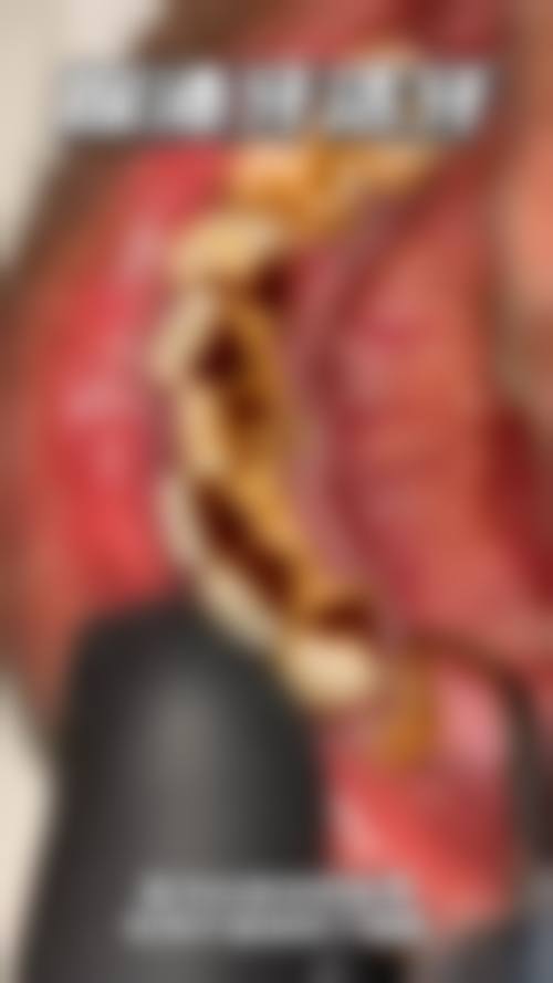 新泰美润口腔(青云小镇店)真实实例