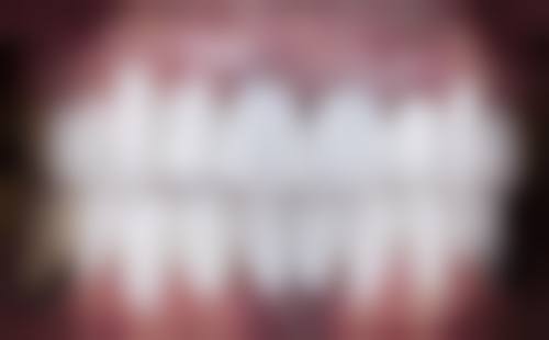 浙江嘉兴陈飞口腔诊所口碑怎么样