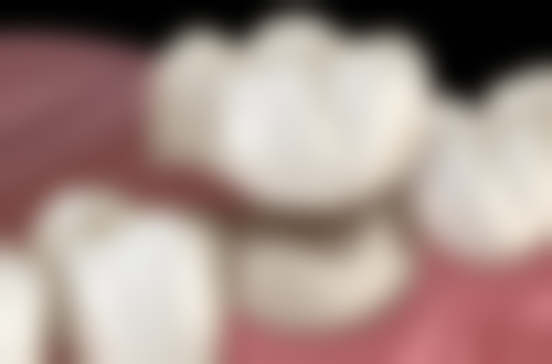 拔牙与牙神经疼的关系是怎样的