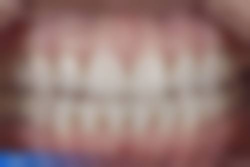 恩施咿呀牙科诊所擅长项目：全方面的口腔呵护