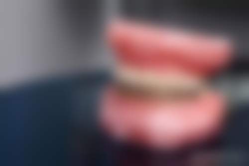 聊城精诚口腔医院真实实例