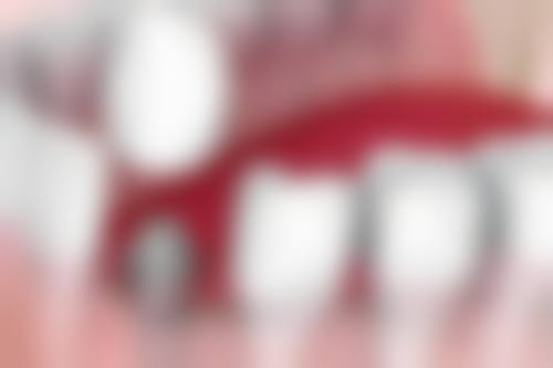 吉林大学口腔医院老年口腔科价格表