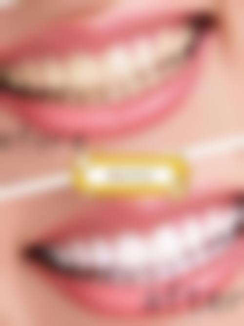 上海李忠林口腔诊所真实实例