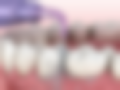 西安德美口腔门诊部价格表