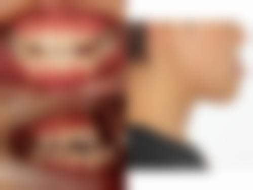 宁波牙壹家口腔门诊部擅长项目