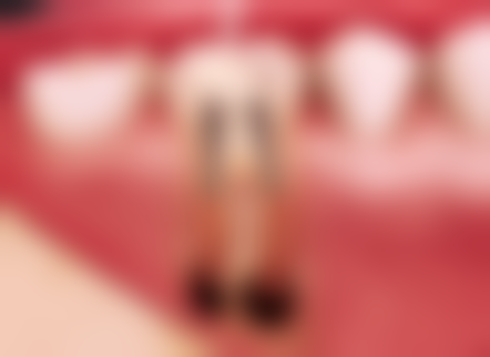 申姗姗医生口碑评价