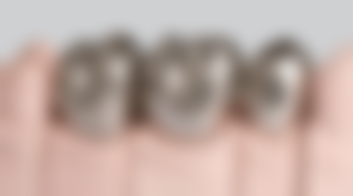 韩国进口种植牙登腾牌子怎么样