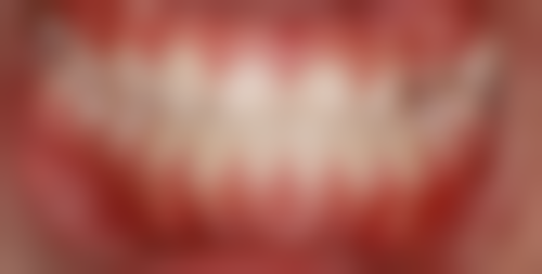 陈祥贵医生技术特点