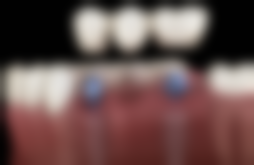 湖南武汉皓丽雅口腔预约挂号方式：便捷效率高不等待