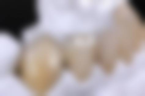 山东威海杜超口腔仪器设备