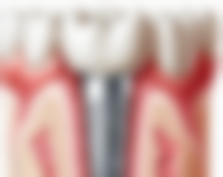 张永珍口腔诊所真实实例