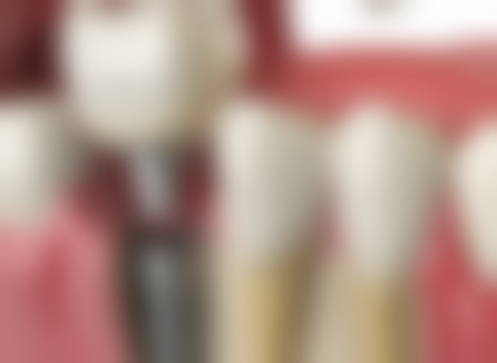 湖北宜昌康贝口腔门诊部擅长项目