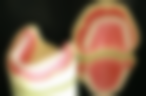 钟红阳医生真实实例