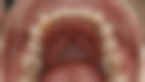 北京微贝口腔口碑怎么样:患者好评如潮