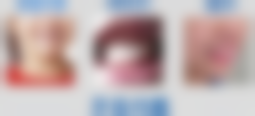 单春城医生技术特点